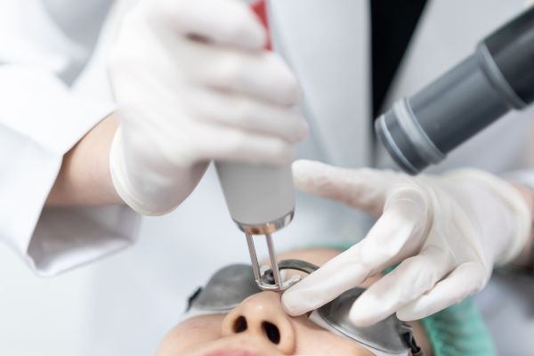 皮秒雷射治療諮詢